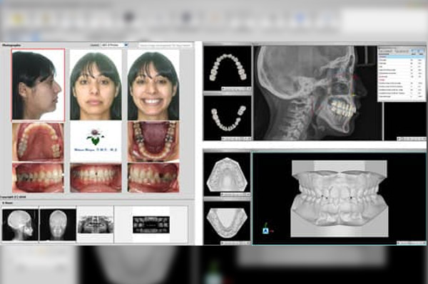 Ortho Share 3D