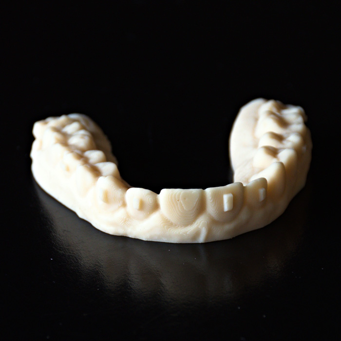 Orthodontic Clear Aligner Custom Made 3D Printed