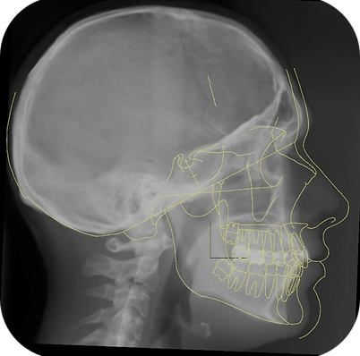 Patient with Adult Male Template