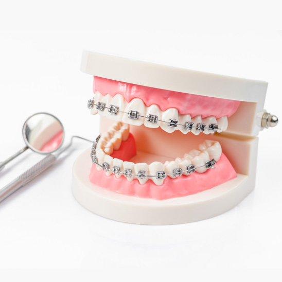 Tooth Model