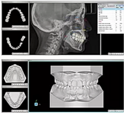 Ortho Share 3D™ Software to help you in many ways 3D IMAGE Organizer