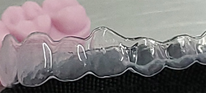 aligner