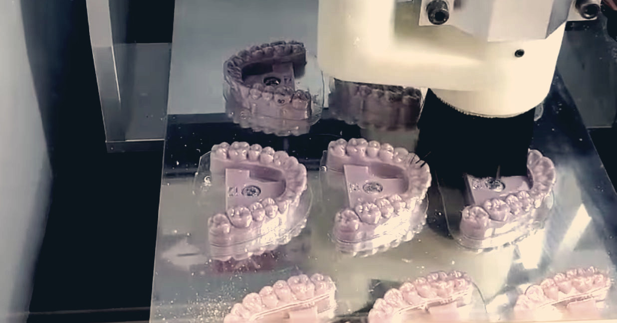 TRIM 9 ALIGNERS UNDER 4 MINUTES